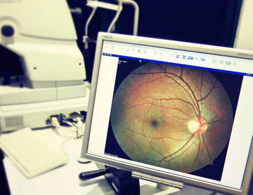 JC retina photo Digital Retinal Camera