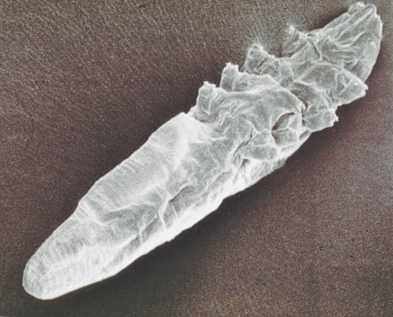 Demodex Folliculorum under Scanning electron microscrope demodex folliculorum