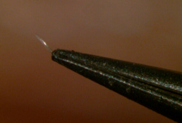 Demodex mite captured with forceps 40x magnification demodex mite