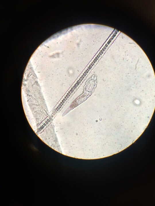 Demodex Folliculorum under conventional microscope demodex folliculorum